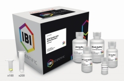 Virus-Nukleinsäure Extraktions-Kit