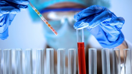 Analytisches Messen und Testen